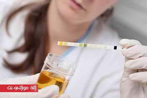 ألوان البول ومعنى كل لون منها