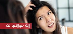 Dandruff-Answered-By-Experts