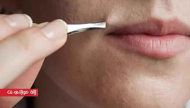 طرق للتخلص من شعيرات فوق الشفاه