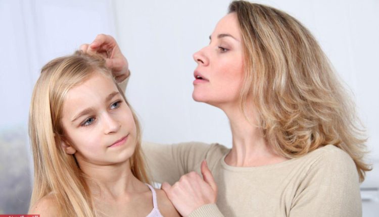 وصفات طبيعية تخلص كفلك من التقمل