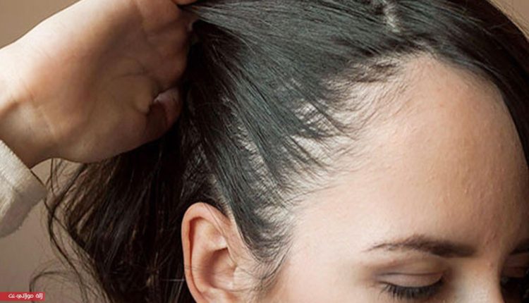 وصفة سهلة للتخلص من فراغات الشعر