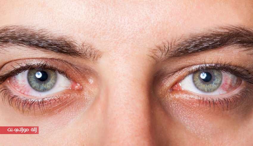 كيف تتجنبون الاصابة بجفاف العين؟