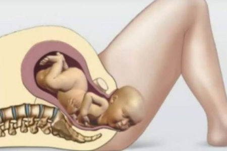 بغا تولدي طبيعيا إليك 4 اشياء تساعد على فتح الرحم بسرعه لتسهيل الولادة ستساعدك